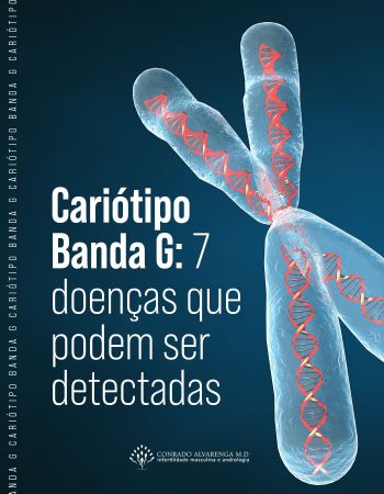 Cariótipo Banda G